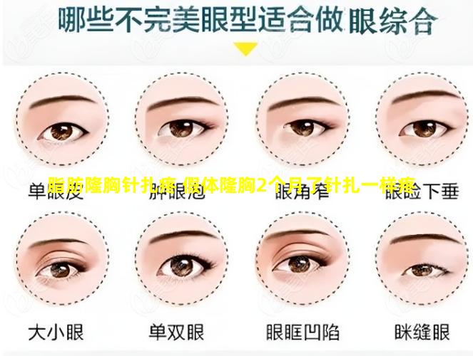 脂肪隆胸针扎疼 假体隆胸2个月了针扎一样疼